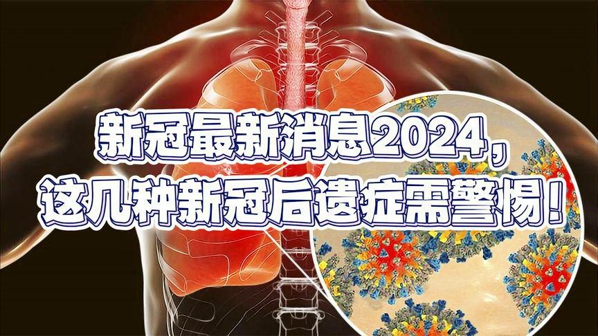 新冠病毒2024年最新消息,灵活设计解析方案_创意版44.771