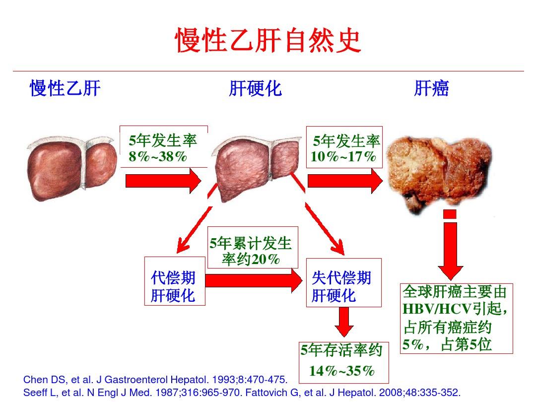 乙肝硬化最新研究进展与前沿治疗方法概述